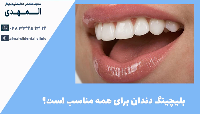 بلیچینگ دندان برای همه مناسب است؟