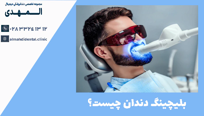 بلیچینگ دندان چیست؟