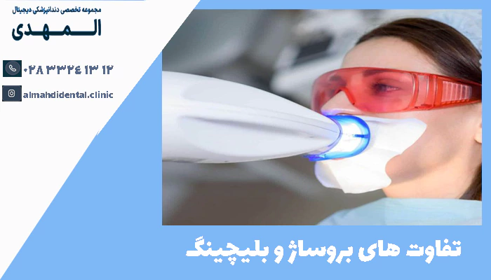 تفاوت های بروساژ و بلیچینگ