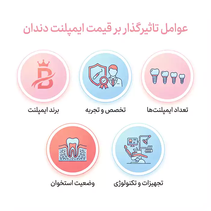 عوامل تاثیرگذار بر قیمت ایمپلنت دندان