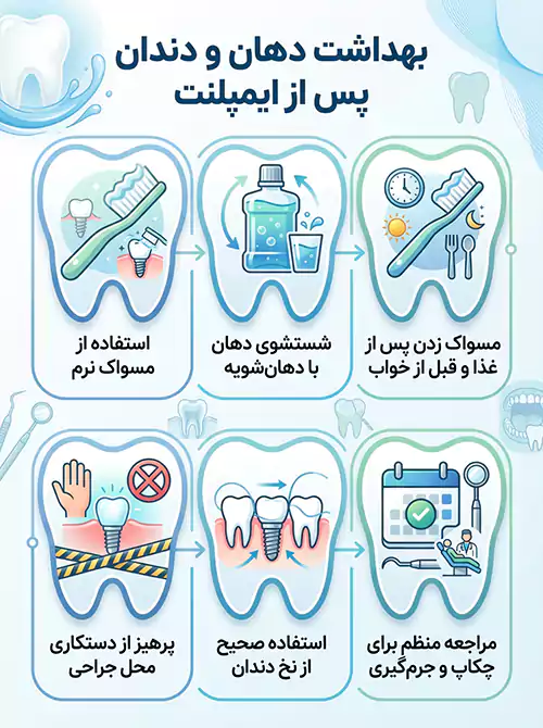 اینفوگرافیک بهداشت ایمپلنت